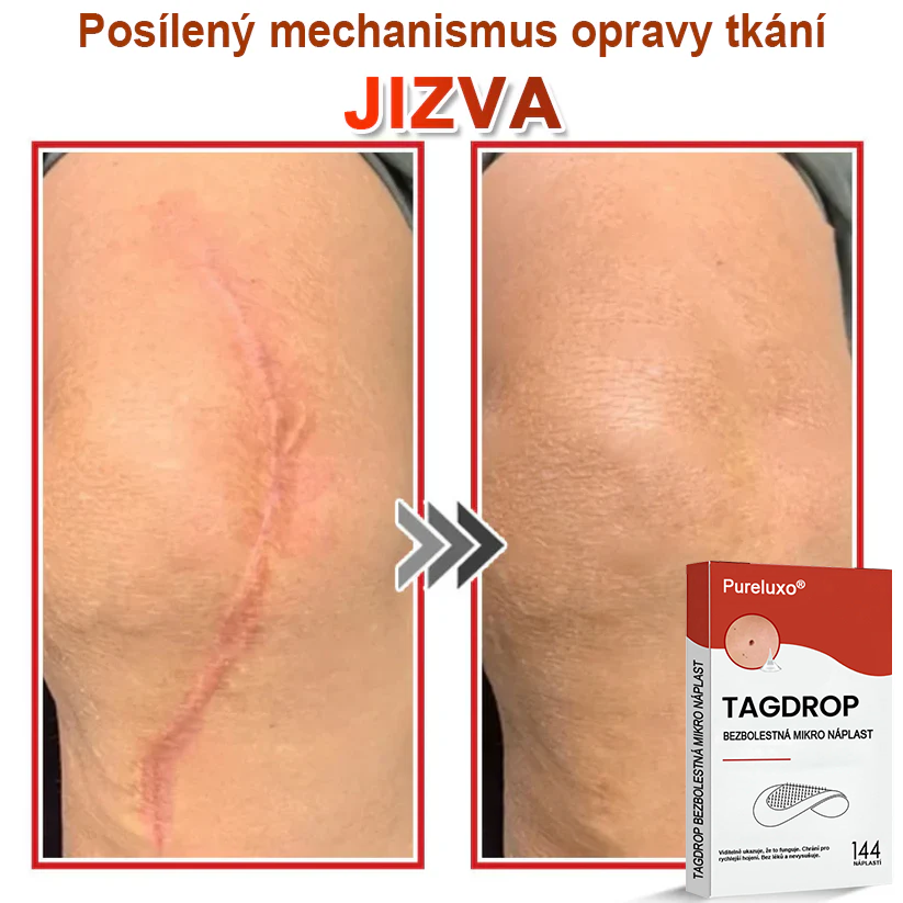 Pureluxo® Mikrovpichová botanická náplast na odstranění kožních výrůstků 🇨🇿 Vyrobeno v Česká republika 🎁