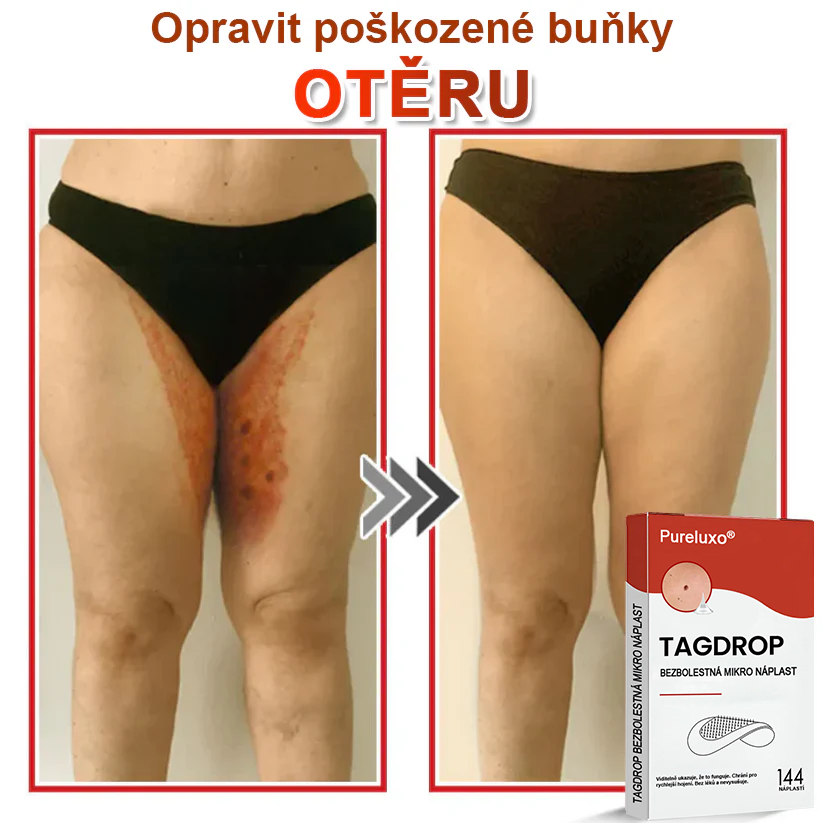 Pureluxo® Mikrovpichová botanická náplast na odstranění kožních výrůstků 🇨🇿 Vyrobeno v Česká republika 🎁