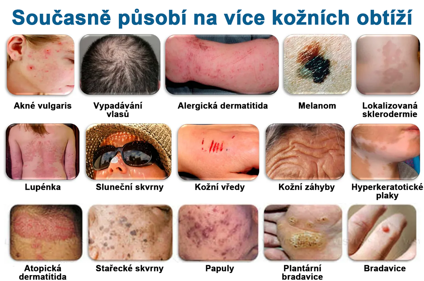 ✅ Pureluxo® Fekete Rizses Bőrregeneráló Krém 👨‍⚕️ (Szemölcsök, bőrkinövések, foltok és hiperpigmentáció kezelésére)✅✅