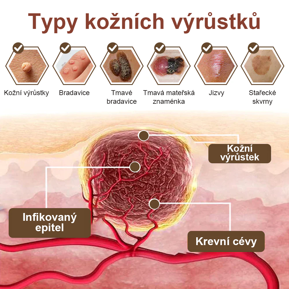 ✅ Pureluxo® Fekete Rizses Bőrregeneráló Krém 👨‍⚕️ (Szemölcsök, bőrkinövések, foltok és hiperpigmentáció kezelésére)✅✅
