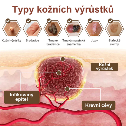 ✅ Pureluxo® Fekete Rizses Bőrregeneráló Krém 👨‍⚕️ (Szemölcsök, bőrkinövések, foltok és hiperpigmentáció kezelésére)✅✅