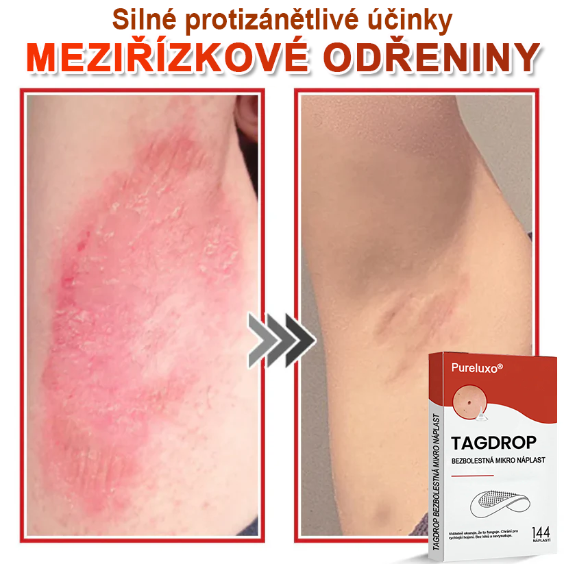 Pureluxo® Mikrovpichová botanická náplast na odstranění kožních výrůstků 🇨🇿 Vyrobeno v Česká republika 🎁