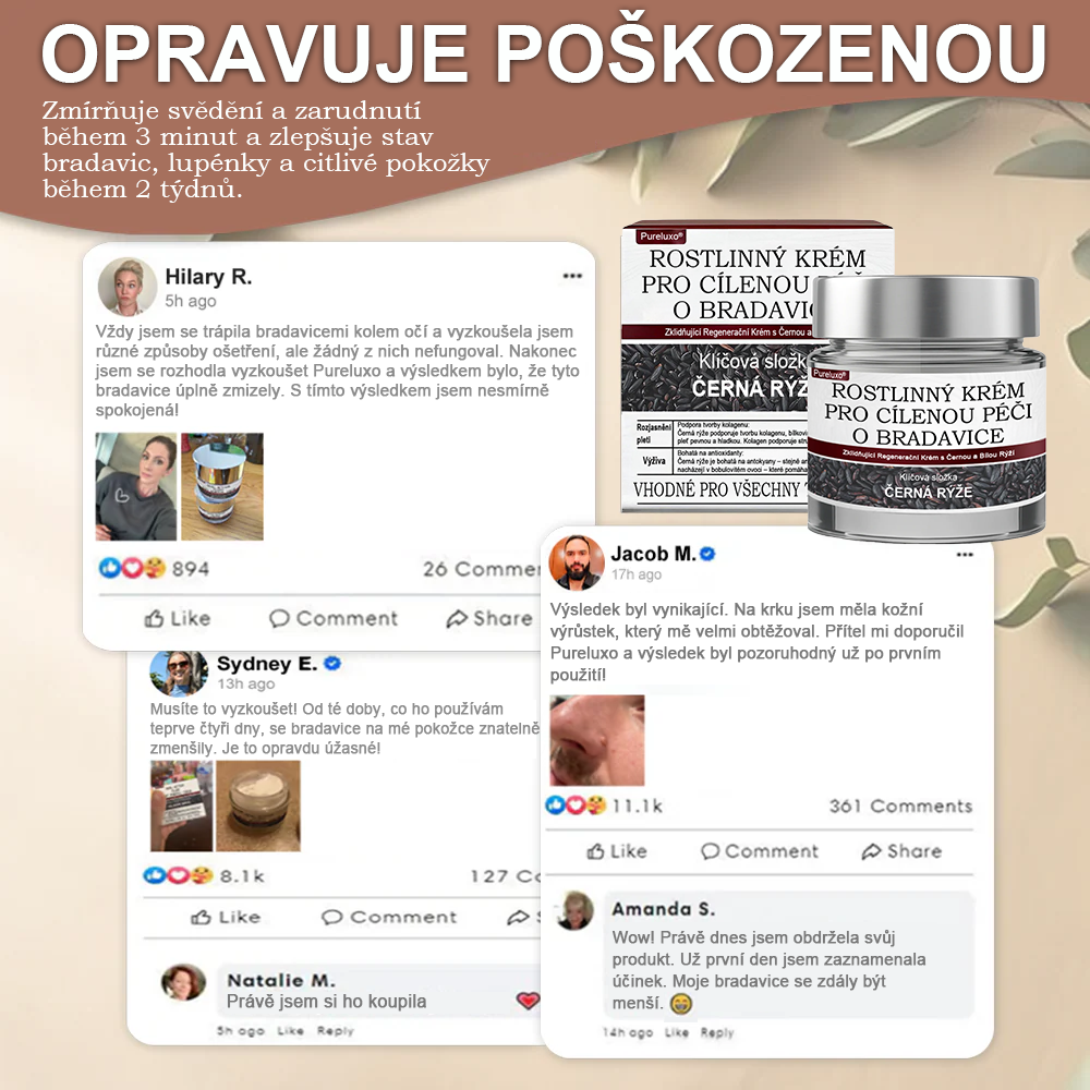 ✅ Pureluxo® Fekete Rizses Bőrregeneráló Krém 👨‍⚕️ (Szemölcsök, bőrkinövések, foltok és hiperpigmentáció kezelésére)✅✅